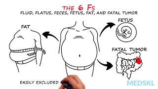 Abdominal Distension The 6 Fs that can help your diagnosis [upl. by Shipp]