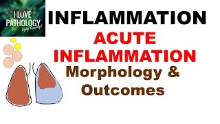 INFLAMMATION Part7 MORPHOLOGY amp OUTCOMES of Acute Inflammation [upl. by Leunas759]