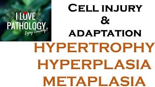 Cell Adaptations pathologyHYPERTROPHY HYPERPLASIA AND METAPLASIA [upl. by Pace]