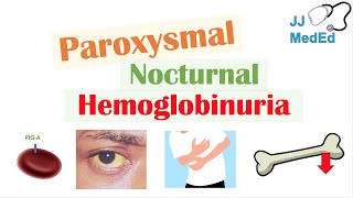 Paroxysmal Nocturnal Hemoglobinuria PNH  Causes amp Pathogenesis Symptoms Diagnosis amp Treatment [upl. by Ahsram]