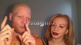 Albinism amp Nystagmus [upl. by Ellertal]