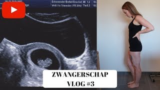 EERSTE ECHO amp MISSELIJK  6 7 amp 8 weken  ZWANGERSCHAP VLOG 3 [upl. by Alleon]