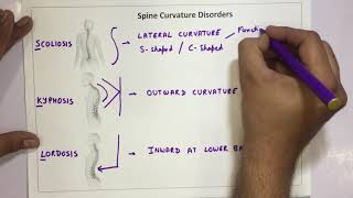 Spine Curvature Disorders  Scoliosis Kyphosis Lordosis [upl. by Yt]