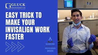 Easy Trick To Make Your Invisalign Work Faster [upl. by Aicilyhp917]