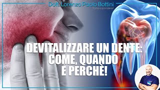 DEVITALIZZARE UN DENTE COME QUANDO E PERCHÈ [upl. by Melak]