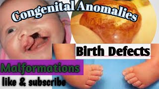 Basics of Congenital Anomalies Birth Defects Malformations [upl. by Giamo]