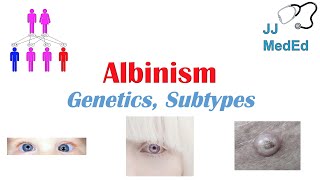 Albinism  Genetics Different Types and What You Need to Know [upl. by Janet]