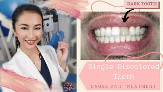 How to treat a discolored or dark tooth  zirconia crown [upl. by Ellac]