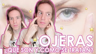 ¿CÓMO SE TRATAN LAS OJERAS Aprende a diagnosticar y tratar tu tipo de ojeras [upl. by Sulamith]