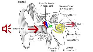 Middle and inner ear tumors [upl. by Asiar21]