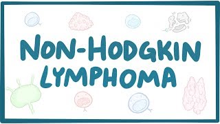 Nonhodgkin lymphoma  causes symptoms diagnosis treatment pathology [upl. by Geier13]