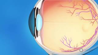 Antiglaucoma Agents  Pharmacology  Nervous System  LevelUpRN [upl. by Walkling]