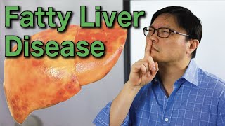 Treating Complications of Cirrhosis  Steven–Huy Han MD  UCLA Digestive Diseases [upl. by Dnalevets]