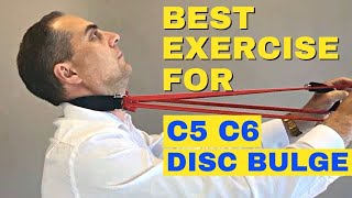 Top 3 Treatments for Degenerative Disc DiseaseLow back exercises [upl. by Anerbas362]