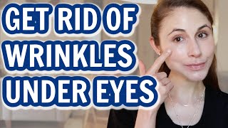 How to GET RID OF UNDER EYE WRINKLES Dr Dray [upl. by Gorlicki]