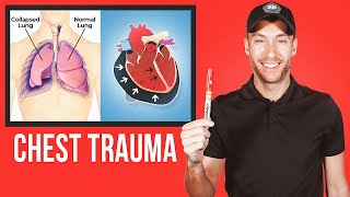 EASY Guide for CHEST TRAUMA [upl. by Ainorev690]