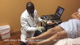 EMG quotNerve Testquot Procedure explained by Dr Ankamah at New Jersey Sports amp Spine Medicine PC [upl. by Silvano451]