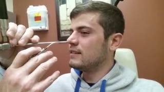 Septoplasty  Nasal Splint Removal  Post Surgery [upl. by Ricarda]