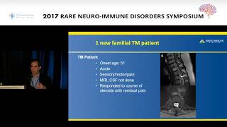 Imaging CNS autoimmune and inflammatory disease  1  IntroductionDemyelinating disease [upl. by Dnaleel299]