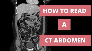 How to read a CT Abdomen for Med students and Residents  Part 1 [upl. by Twum]