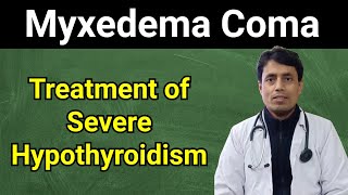 Myxedema Coma  Untreated Hypothyroidism  Serious Hypothyroidism  DrSanjayChestSpecialist [upl. by Raskind6]