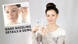 Nano Needling vs Microneedling  Demo amp Details [upl. by Arikat]