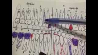 como llenar un odontograma o dentigrama [upl. by Marjory]