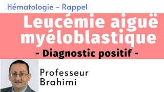 Leucémie Aiguë Myéloblastique Diagnostic positif [upl. by Linsk898]