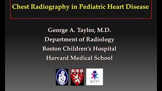 Aortic Stenosis in Seniors Explained [upl. by Yrolg]