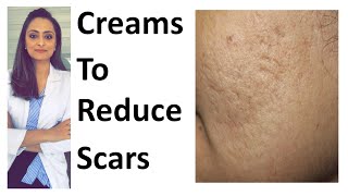 How to remove scars  Scar creams  tretinoin  Tazarotene  dr Aanchal  Dermatologist [upl. by Ithnan]