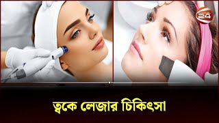 লেজার চিকিৎসার সুবিধাঅসুবিধা  Channel 24  Laser Treatment [upl. by Sherrie]