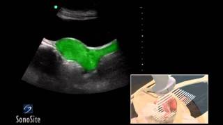 How To Female Pelvis Ultrasound Exam 3D Video [upl. by Roland]