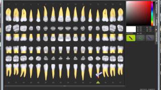 Odontograma actualizado [upl. by Macilroy]