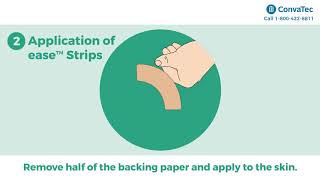 How to use ease™ Strips from ConvaTec to help secure your ostomy pouching system [upl. by Akemor]