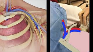 Central Vascular Access Anatomy of the Subclavian [upl. by Trixi]