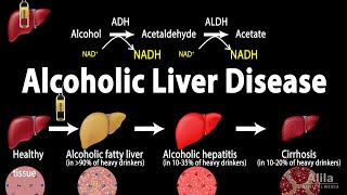 Alcoholic Liver Disease Animation [upl. by Yrrap39]