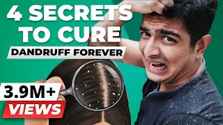 4 SECRET Tips To Remove Dandruff Forever  BeerBiceps Health [upl. by Ainegue]