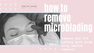 How To Remove Microblading With Saline Tattoo Removal [upl. by Maddalena]