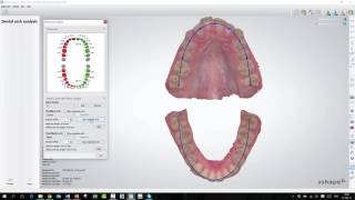 3Shape Ortho Analyzer  How to Make a Dental Arch Analysis [upl. by Akiv]