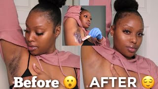 WAX Your Underarms AT HOME  How To Lighten Dark Underarms Naturally Detailed [upl. by Farron]