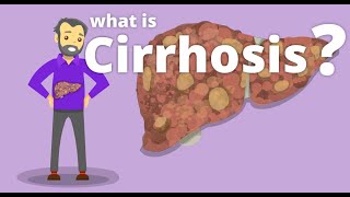 Cirrhosis  What is cirrhosis [upl. by Antonio]