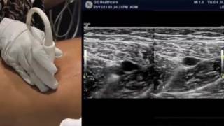 How To Lower Extremity Ultrasound [upl. by Ihn869]