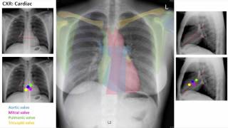 Anatomy of a Chest XRay [upl. by Bennett]