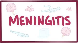 Meningitis  causes symptoms diagnosis treatment pathology [upl. by Epstein]