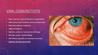 Conjunctivitis [upl. by Natsirt]