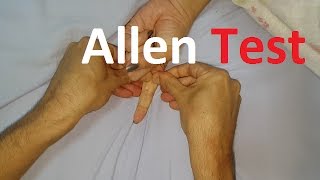 Allen´s Test  Radial vs Ulnar arteries [upl. by Aiselad]