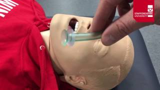 Nasopharyngeal Airway Insertion [upl. by Daly]