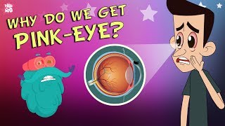 What Causes Conjunctivitis  CONJUNCTIVITIS  PinkEye  The Dr Binocs Show  Peekaboo Kidz [upl. by Yasmeen788]