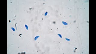 Toxoplasma gondii  live trophozoites [upl. by Eyahc]