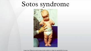 Sotos syndrome [upl. by Hpeseoj]